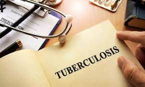 Novel approach identifies people at risk of developing TB: Lancet study